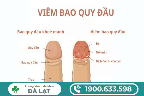 Hình ảnh minh họa